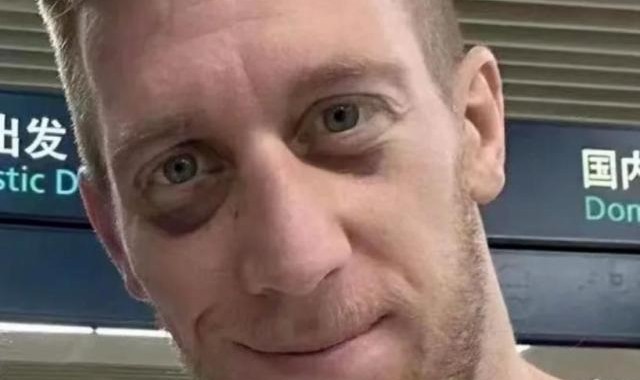 开云在线-贝里奇带伤火线驰援 津门虎客战大连人争10轮不败